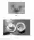 Fig. 04 - ARTIFICIAL BONE FORMS AND COMPOSITIONS FOR APPROXIMATING BONE