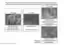Fig. 04 - CELL CONSTRUCT FOR CELL TRANSPLANTATION, BIOCOMPATIBLE POLYMER BLOCK, AND METHOD FOR PRODUCING THE SAME