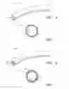 Fig. 04 - Extracellular Matrix Prostheses for Treating Damaged Biological Tissue