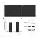 Fig. 06 - Preparation of extracellular matrix-modified tissue engineered nerve grafts for peripheral nerve injury repair