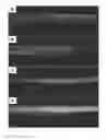 Fig. 08 - Preparation of extracellular matrix-modified tissue engineered nerve grafts for peripheral nerve injury repair