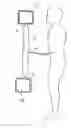 Fig. 01 - MEDICAL DEVICE