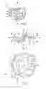 Fig. 02 - Device for promoting fistula patency and method
