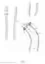Fig. 03 - Device for promoting fistula patency and method