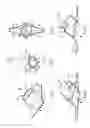 Fig. 02 - Device for forming fistula between blood vessels, and method