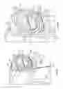 Fig. 19 - Occlusion sensing for an infusion pump