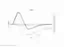 Fig. 10 - Insulin on board calculation, schedule and delivery