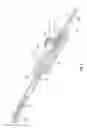 Fig. 07 - INJECTION DEVICE FOR MINIMALLY INVASIVE PROCEDURES AND USES THEREOF