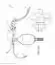 Fig. 03 - DEVICE HAVING MANUAL RESUSCITATION AND SUCTION CAPABILITIES
