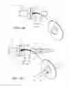 Fig. 06 - DEVICE HAVING MANUAL RESUSCITATION AND SUCTION CAPABILITIES
