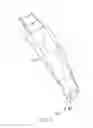 Fig. 04 - Bite Proof Endotracheal Tube
