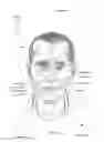Fig. 07 - Patient interface