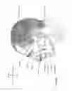 Fig. 08 - Patient interface