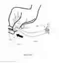 Fig. 145 - Patient interface