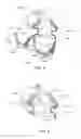 Fig. 19 - Patient interface