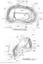 Fig. 201 - Patient interface