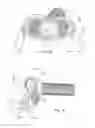 Fig. 30 - Patient interface