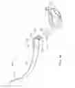 Fig. 41 - Patient interface