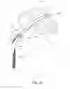 Fig. 79 - Patient interface