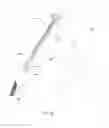 Fig. 87 - Patient interface