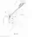 Fig. 89 - Patient interface