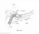 Fig. 93 - Patient interface