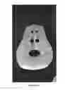 Fig. 17 - Liner for use with respiratory mask