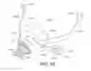 Fig. 75 - Patient interface and method for making same