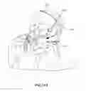 Fig. 92 - Patient interface and method for making same