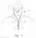 Fig. 02 - Ventilation interface for sleep apnea therapy