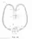 Fig. 03 - Ventilation interface for sleep apnea therapy