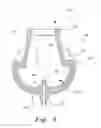 Fig. 06 - Ventilation interface for sleep apnea therapy
