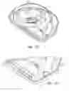 Fig. 09 - Packaging for catheter treatment devices and associated devices, systems and methods