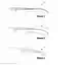 Fig. 02 - Removable angled guidewire storage device
