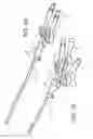Fig. 02 - Catheters having an antimicrobial treatment
