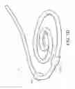 Fig. 04 - Catheters having an antimicrobial treatment