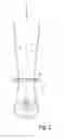 Fig. 03 - Blood cannula
