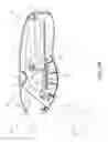 Fig. 06 - Retraction and aspiration device for treating embolism and associated systems and methods