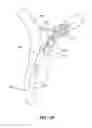 Fig. 12 - Retraction and aspiration device for treating embolism and associated systems and methods