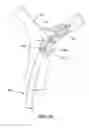 Fig. 13 - Retraction and aspiration device for treating embolism and associated systems and methods