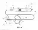 Fig. 02 - Medical device with a nested lap joint and fused conductive element and method for fabricating the same