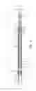 Fig. 04 - Deflectable catheter shaft section