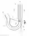 Fig. 09 - Variable curvature catheter