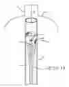 Fig. 12 - Apparatus and processes for applying substances within mammalian tissue
