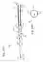 Fig. 11 - Devices, systems, and methods for auto-retroperfusion of the cerebral venous system