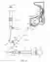 Fig. 11 - Balloon catheter inflation apparatus and methods