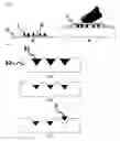 Fig. 03 - Microneedle, mould for producing same, and production method for same