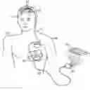 Fig. 01 - Method and apparatus for fluid delivery