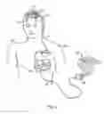 Fig. 03 - Method and apparatus for fluid delivery