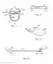 Fig. 06 - Method and apparatus for fluid delivery